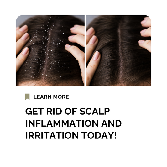 How to get Rid of Scalp Inflammation and Irritation Today!