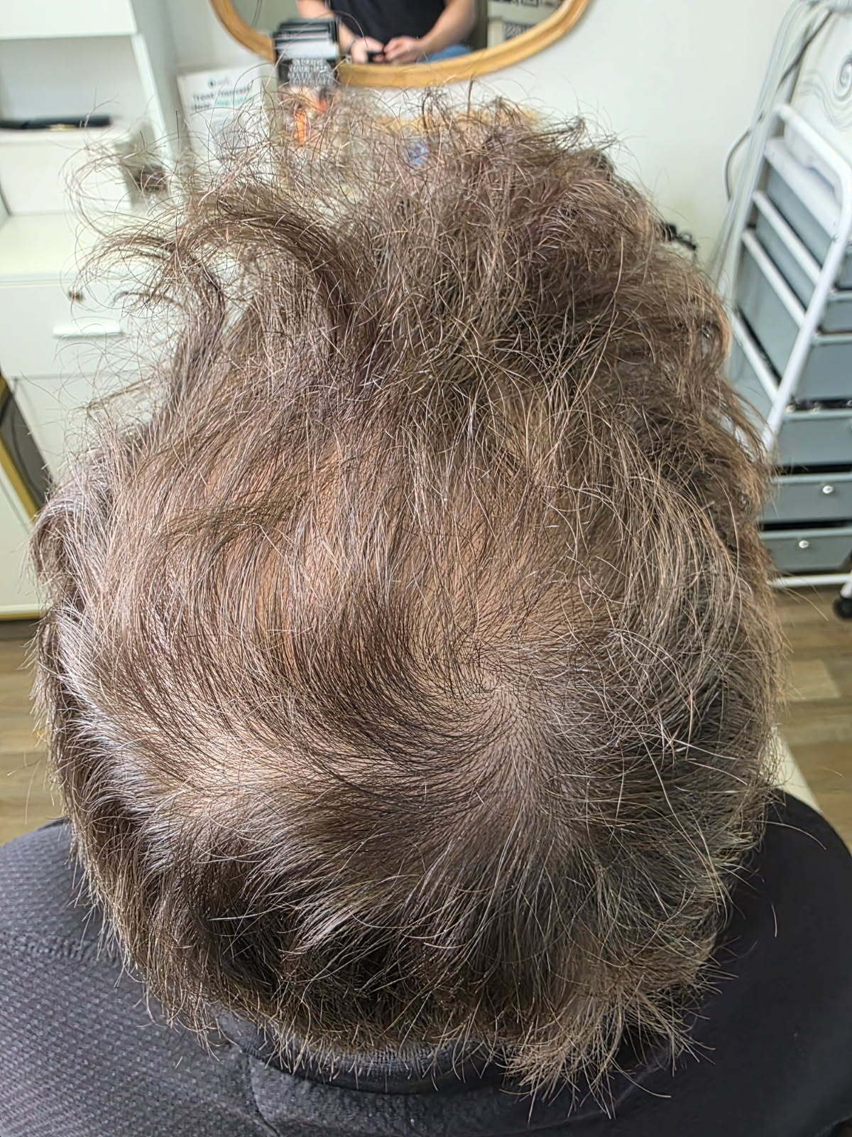 Regrowth Booster Trio – Hair Loss Treatment for Men & Women – Tri